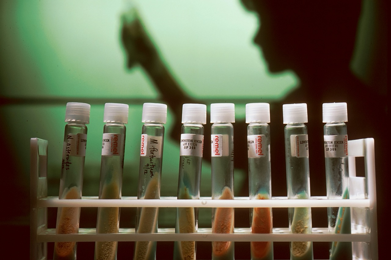 Why Regular STD Testing Is More Important Than You Think