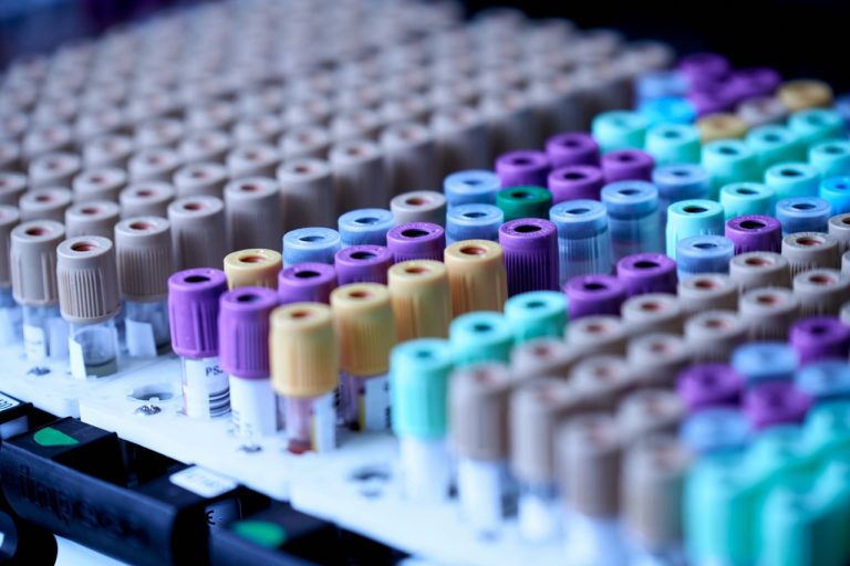 Do Home STD Test Kits Really Work?